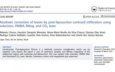 Correção Estética de Lesão por Infiltração de Corticoide Pós-lipoaspiração utilizando Subcisão, PMMA e Laser CO2 fracionado: relato de caso