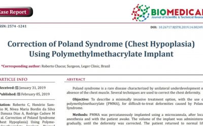 Correção de Síndrome de Poland com implante de PMMA