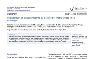 Dr. Roberto Chacur publica artigo sobre substituição de prótese de silicone por PMMA no glúteo