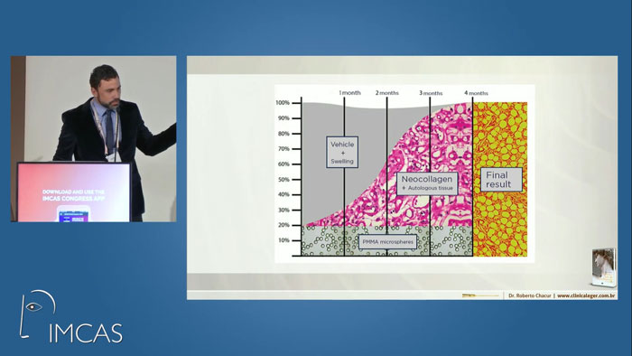 dr roberto chacur representa em gráfico a estimulação de colágeno do pmma ao longo de quatro meses durante congresso IMCAS janeiro de 2020 paris