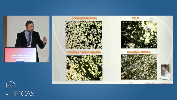 dr roberto chacur mostra microscopia de bioestimuladores de colágeno na apresentação do IMCAS em janeiro de 2020 em paris