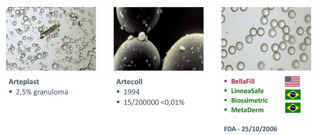 microscopia das três gerações do pmma mostrando partículas de tamanho irregular, impurezas no veículo até partículas de superfície lisa