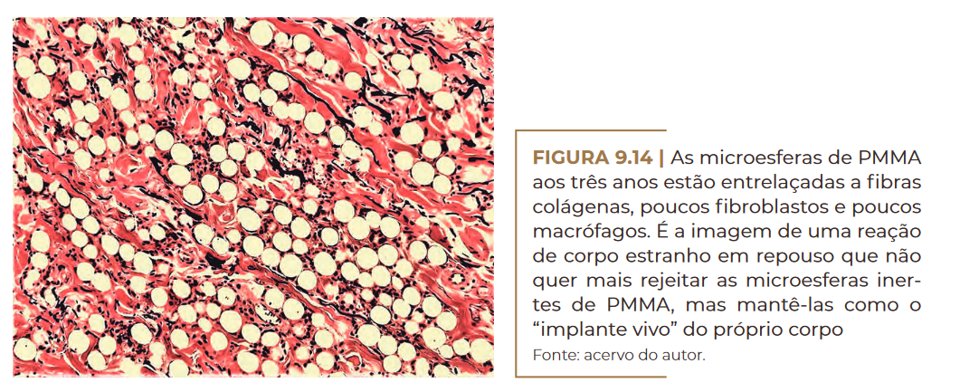 As microesferas de PMMA aos três anos