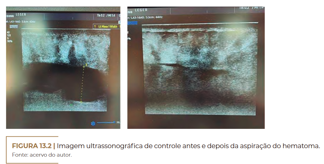 Imagem ultrassonográfica de controle
