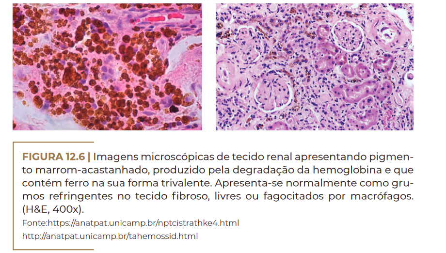 Imagens microscópicas de tecido renal cap 12