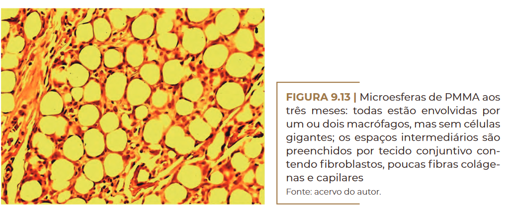 Microesferas de PMMA aos três meses: