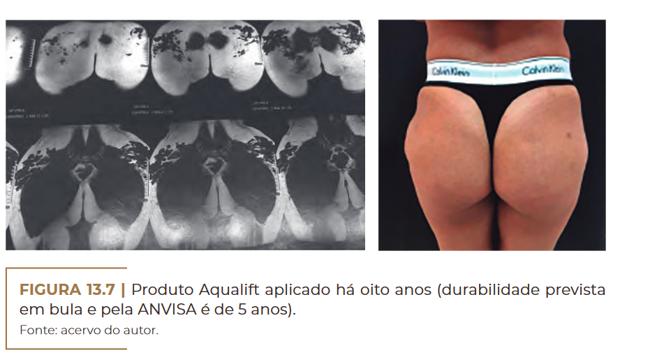 Produto Aqualift 