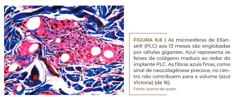 as-microesferas-de-ellanse