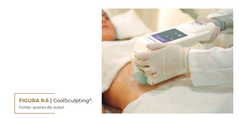 CoolSculpting®