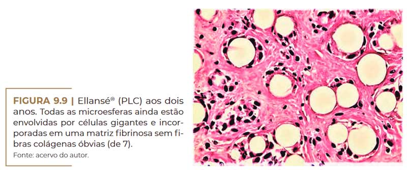 ellanse-microscopia-2-anos