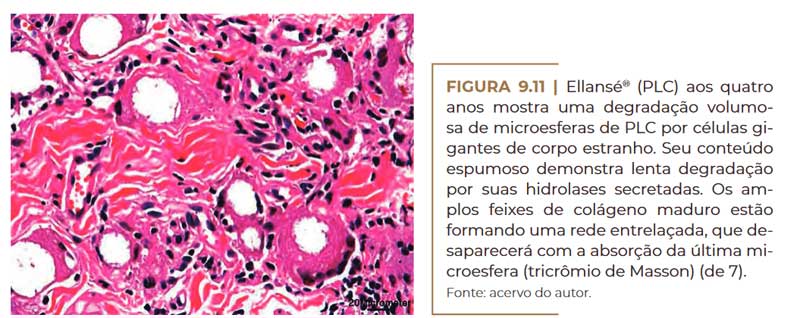 ellanse-microscopia-4-anos