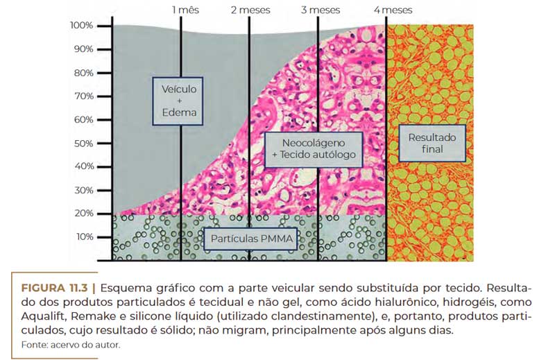 grafico-evolucao-pmma