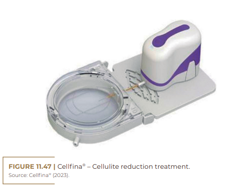 Cellfina® – Cellulite reduction treatment.