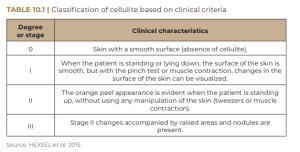 Classification of cellulite based on clinical criteria