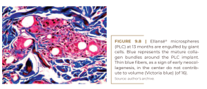 Ellansé® microspheres (PLC) at 13 months