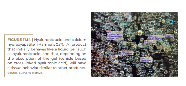 Hyaluronic acid and calcium hydroxyapatite (HarmonyCa®)