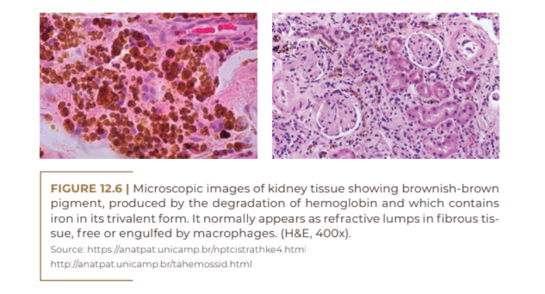 Microscopic images of kidney tissue showing brownish-brown