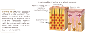 Morpheus Burst before and after treatment