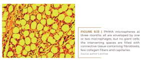 PMMA microspheres at three months: