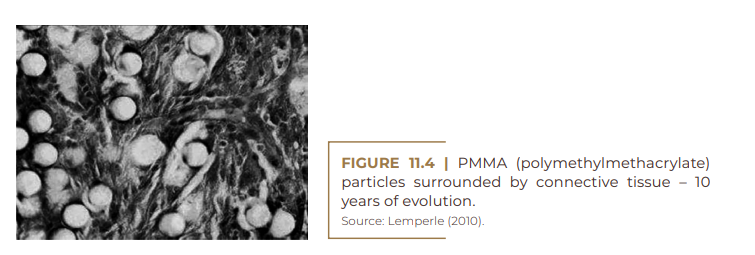 PMMA (polymethylmethacrylate)