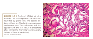 Sculptra® (PLLA) at nine  months.