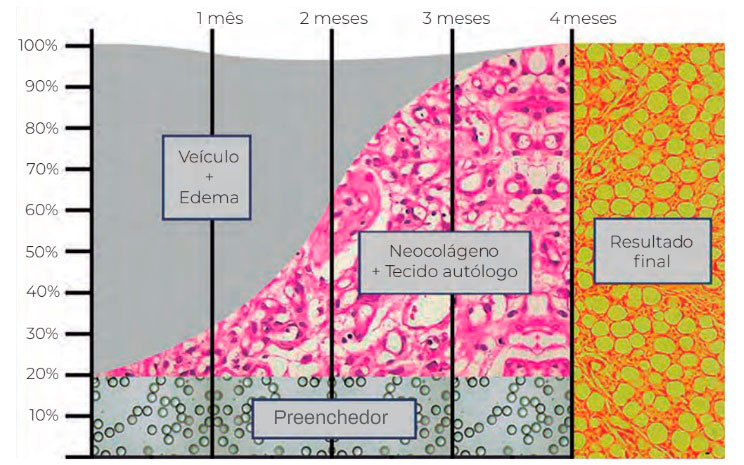 grafico de tempo por porcentagem mostra o estimulo de colageno de 20% de preenchedor de longa duração para 80% de tecido do próprio paciente em 4 meses